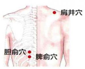 针灸推拿去哪里学