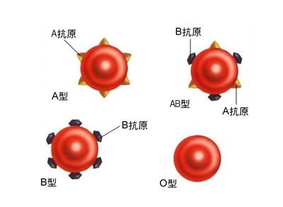 abo溶血有生命危险吗