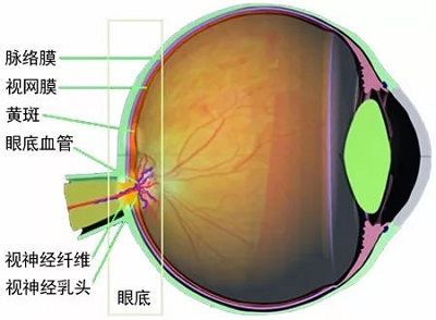 眼底出血的原因及危害