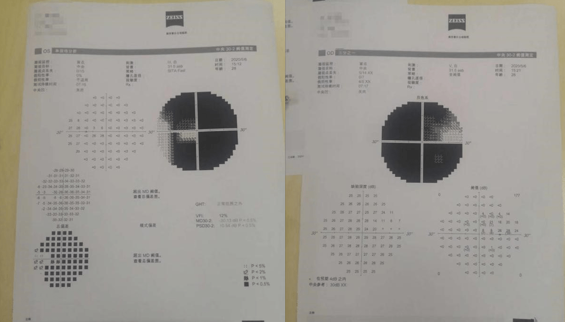 眼干眼痒眼药水推荐