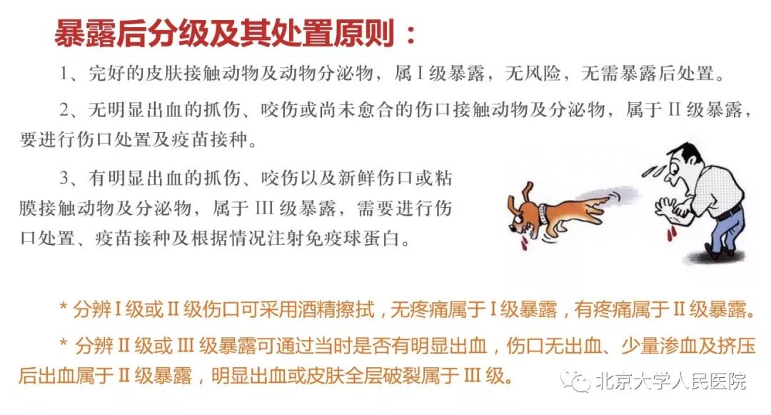 狂犬病潜伏期一般多长时间有症状