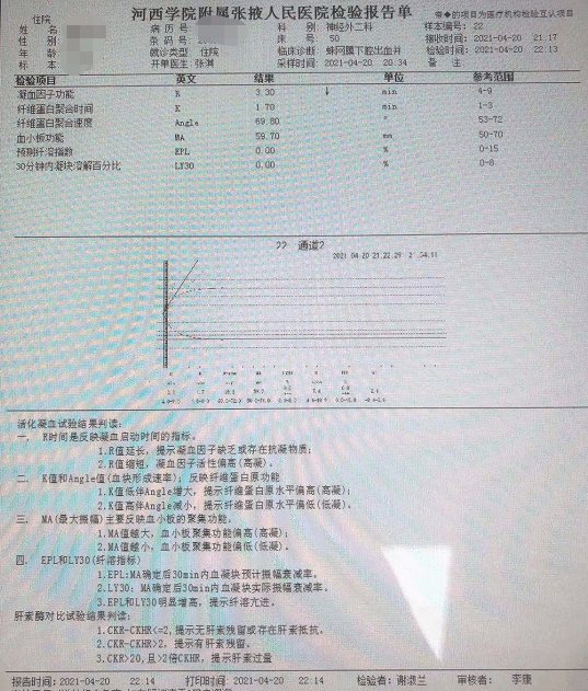 面料弹力测试方法