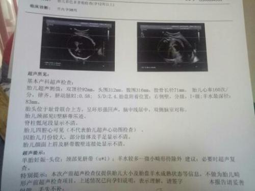 31周羊水指数多少mm正常